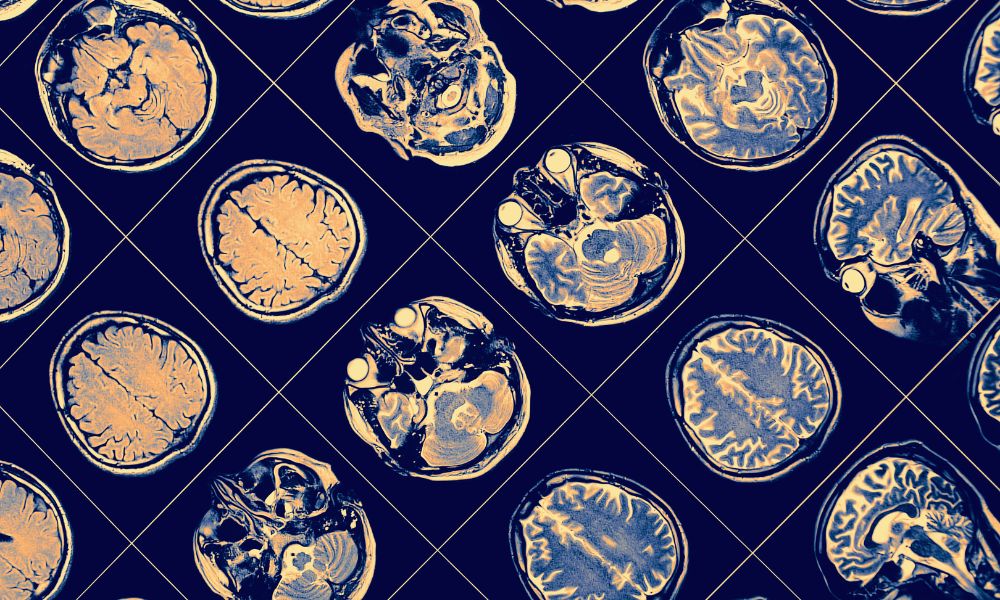 how does technology addiction affect the brain
